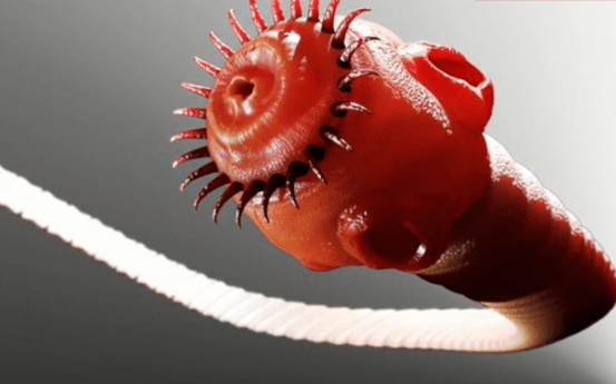 parasit cacing dari tubuh manusia
