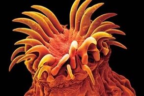 Parasit Trematoda pada manusia