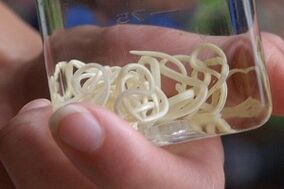 parasit dari tubuh manusia