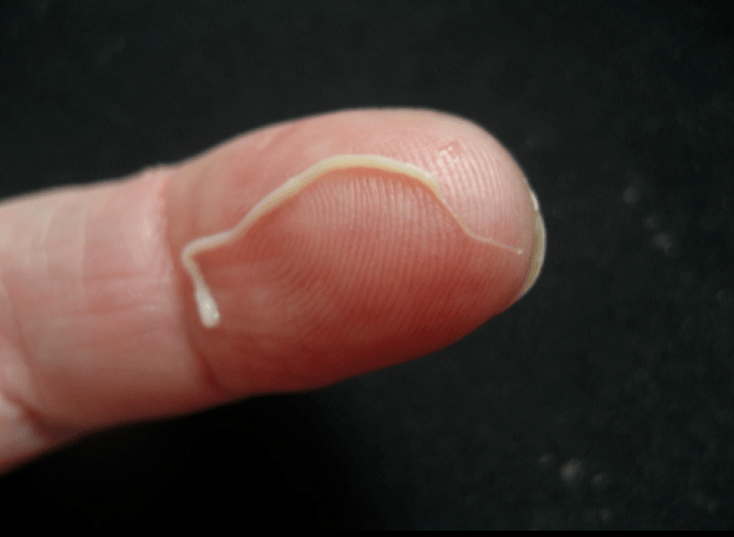 parasit cacing gelang dari tubuh manusia